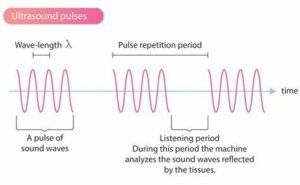 Your Guide to OB Ultrasound Tech School